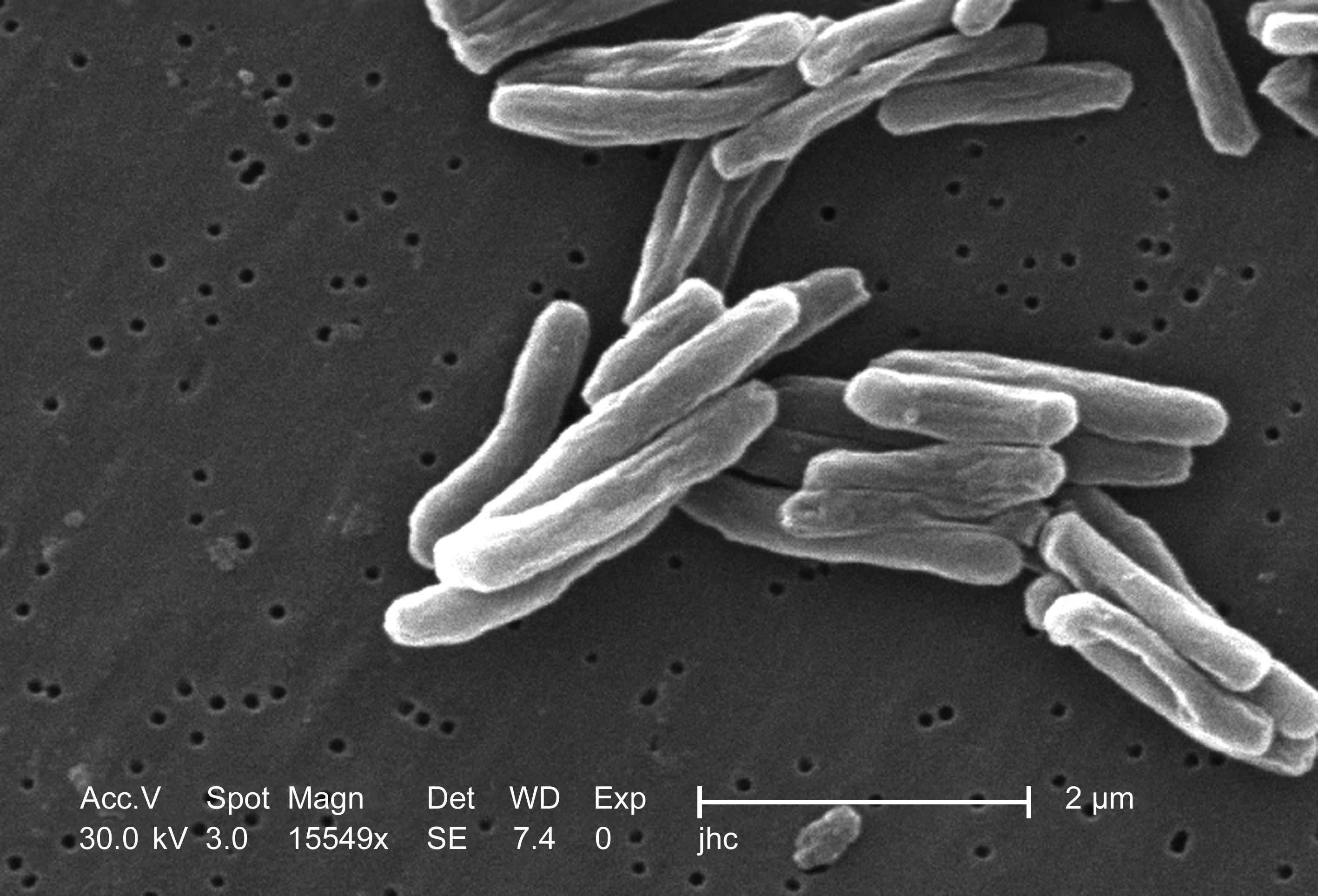 Ученые выяснили белковую причину успеха возбудителя туберкулеза