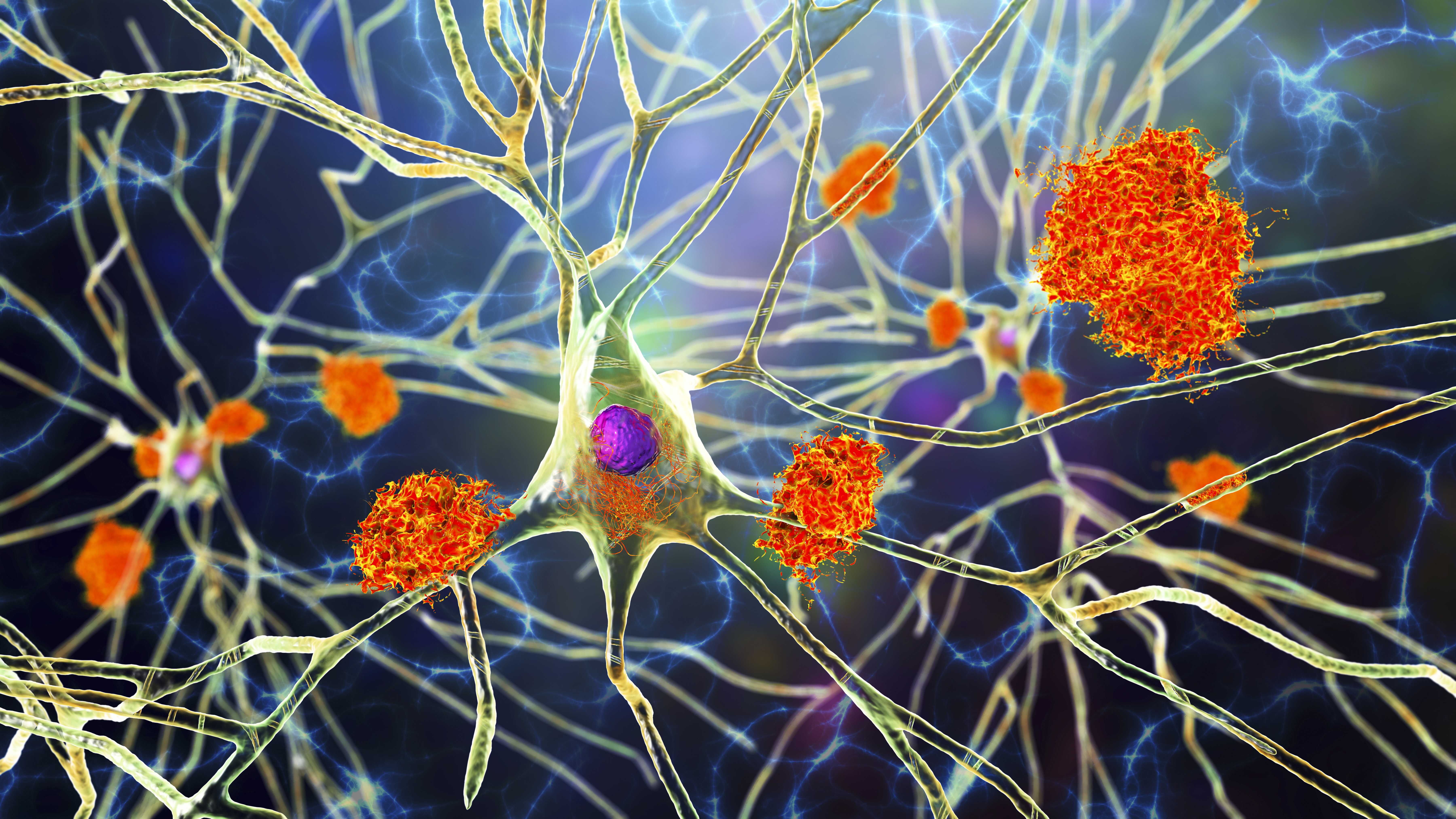 Активация микроглиального рецептора TREM2 замедляет прогрессирование нейродегенеративных заболеваний