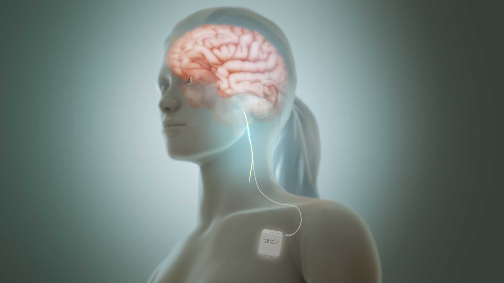 Стимуляция блуждающего нерва усиливает связи между желудком и мозгом
