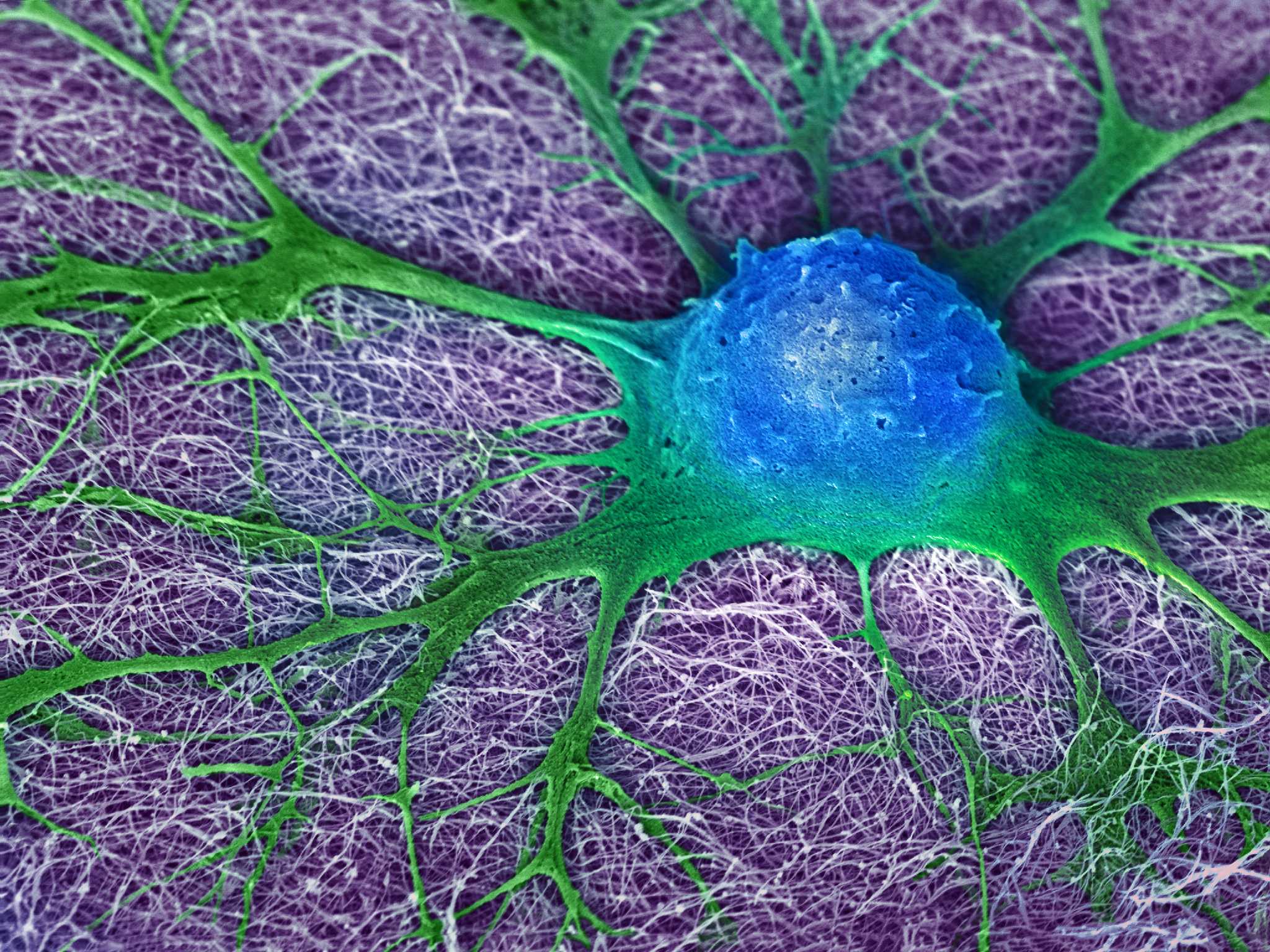 Гидрогель со стволовыми клетками помогает лечить мозг