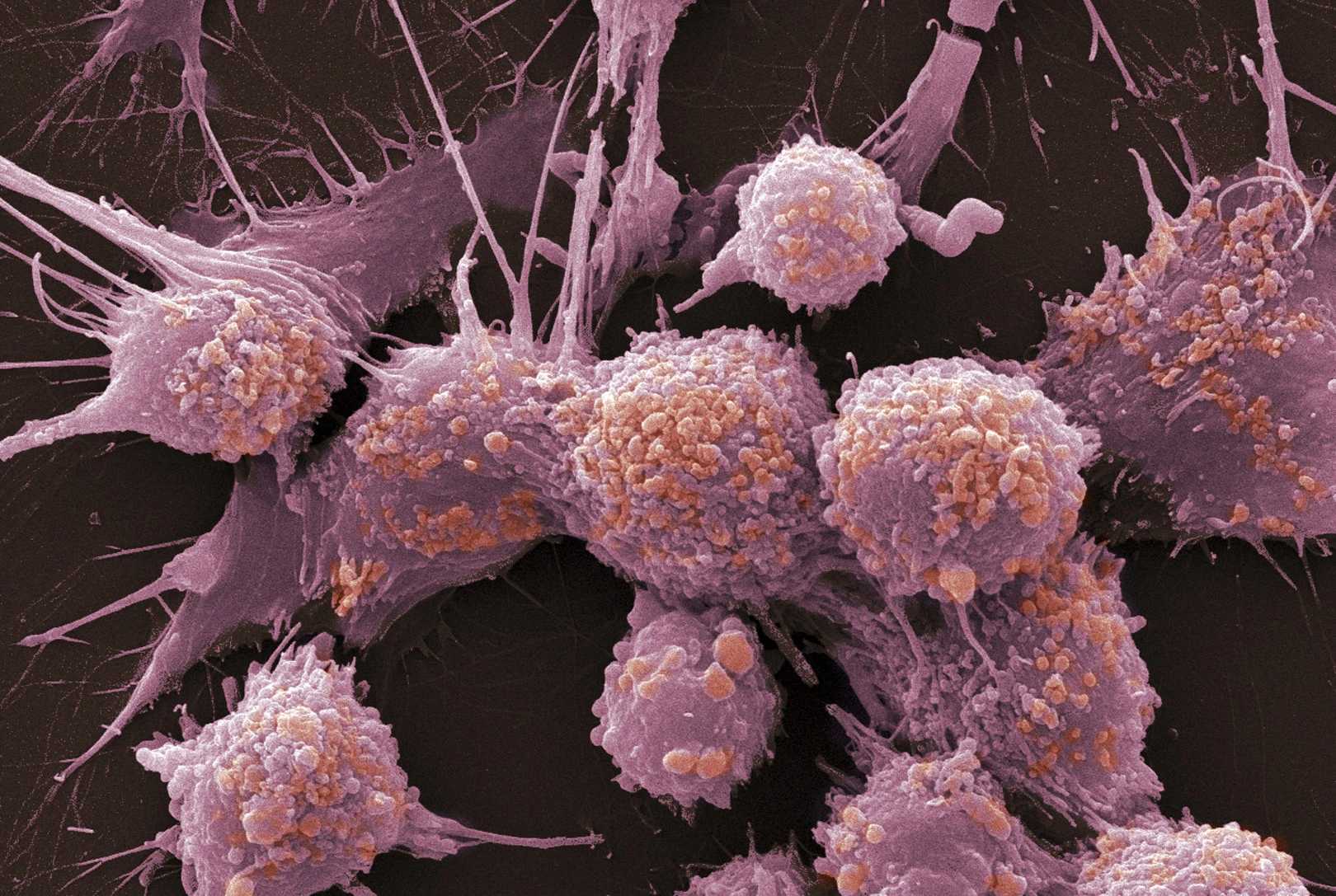Раковые клетки превратили в ликвидаторов их «родной» опухоли