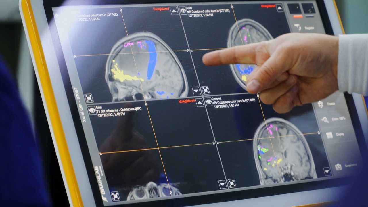 Гибрид микрохирургии и искусственного интеллекта для лечения опухоли мозга