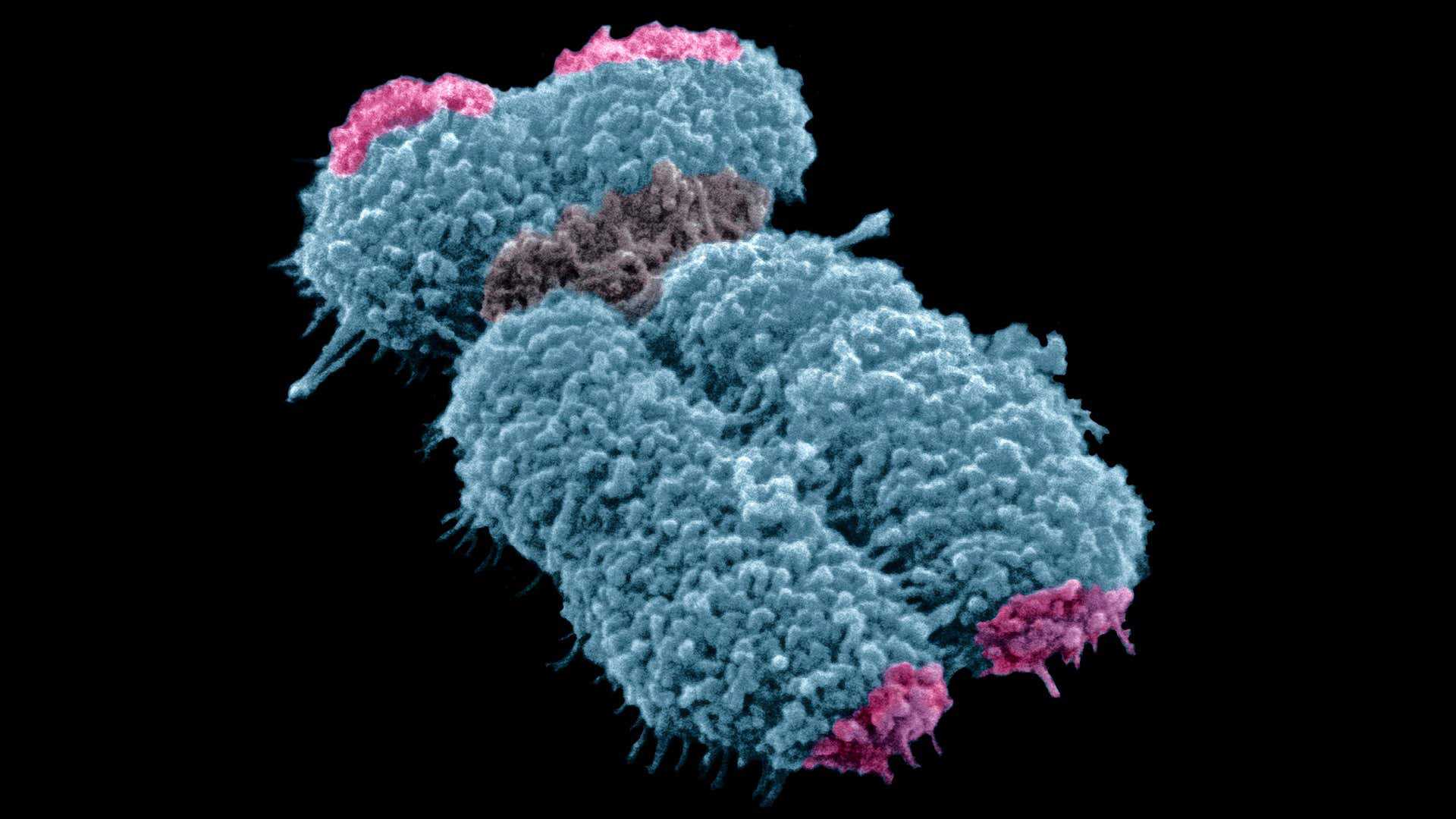 Биологи узнали, как раковые клетки удлиняют свои теломеры