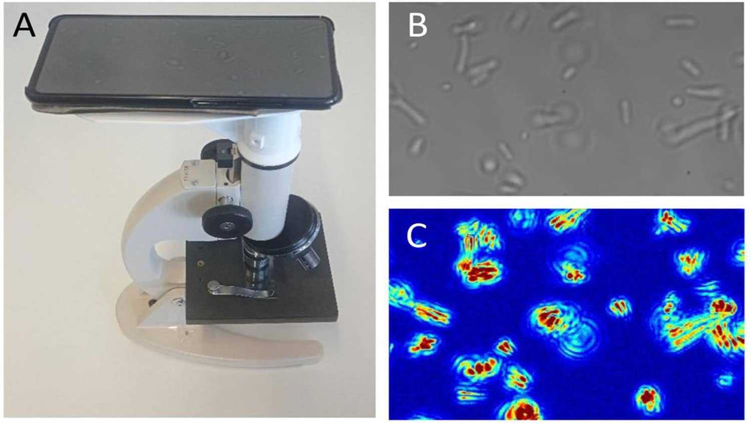 Наноколебания помогли разглядеть резистентных бактерий под микроскопом