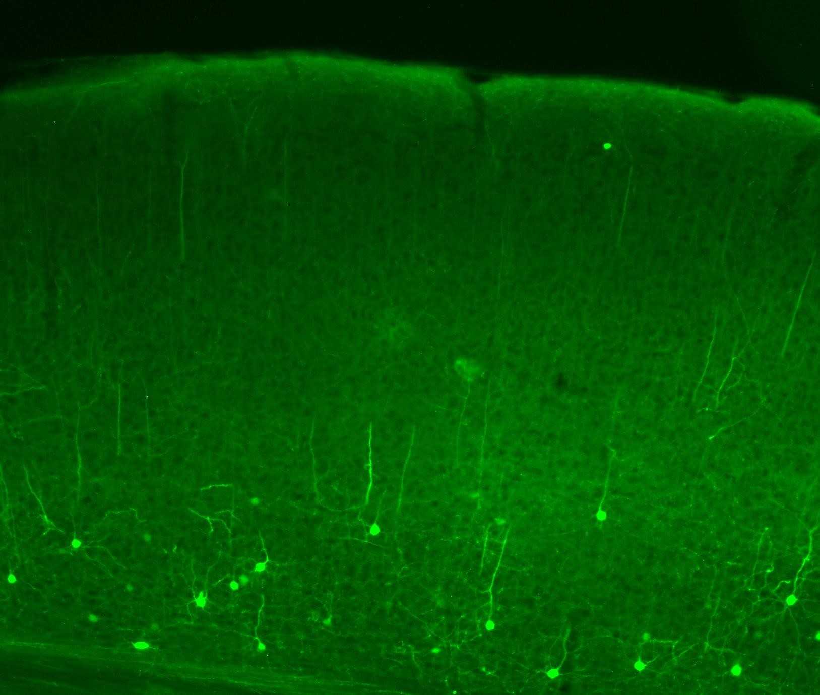 Нервным клеткам пришлось «изменить себя» ради запоминания информации
