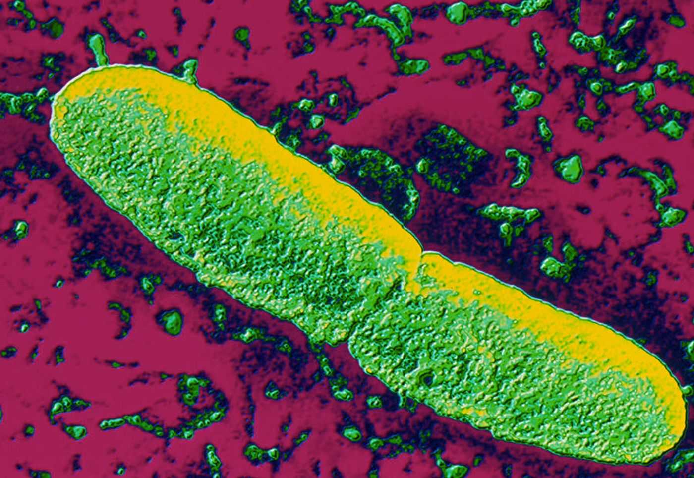 Ученые нашли следы самой древней эпидемии чумы в Британии