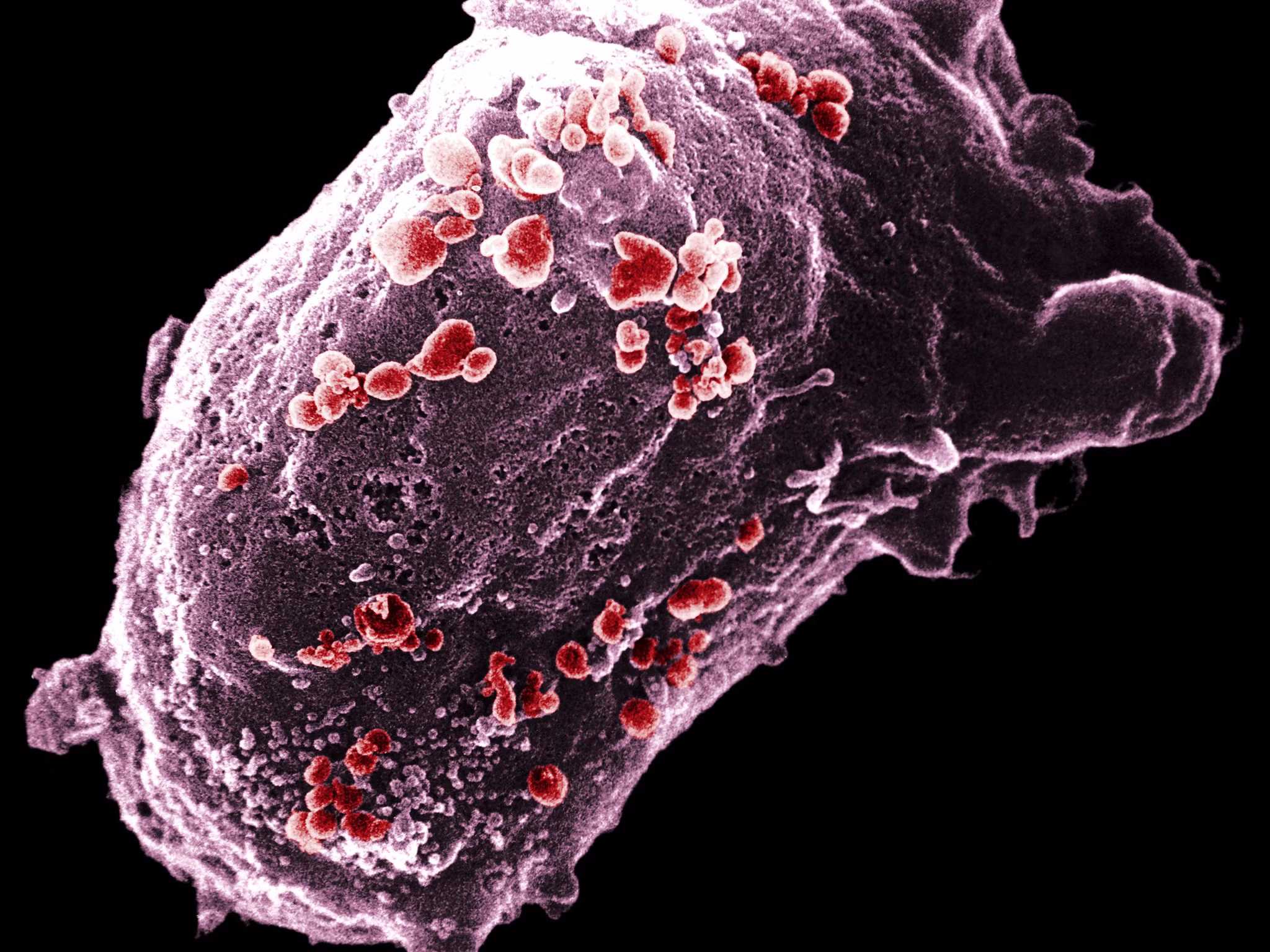 ВОЗ повысила уровень «непередаваемой» вирусной нагрузки ВИЧ до 1000 копий на миллилитр