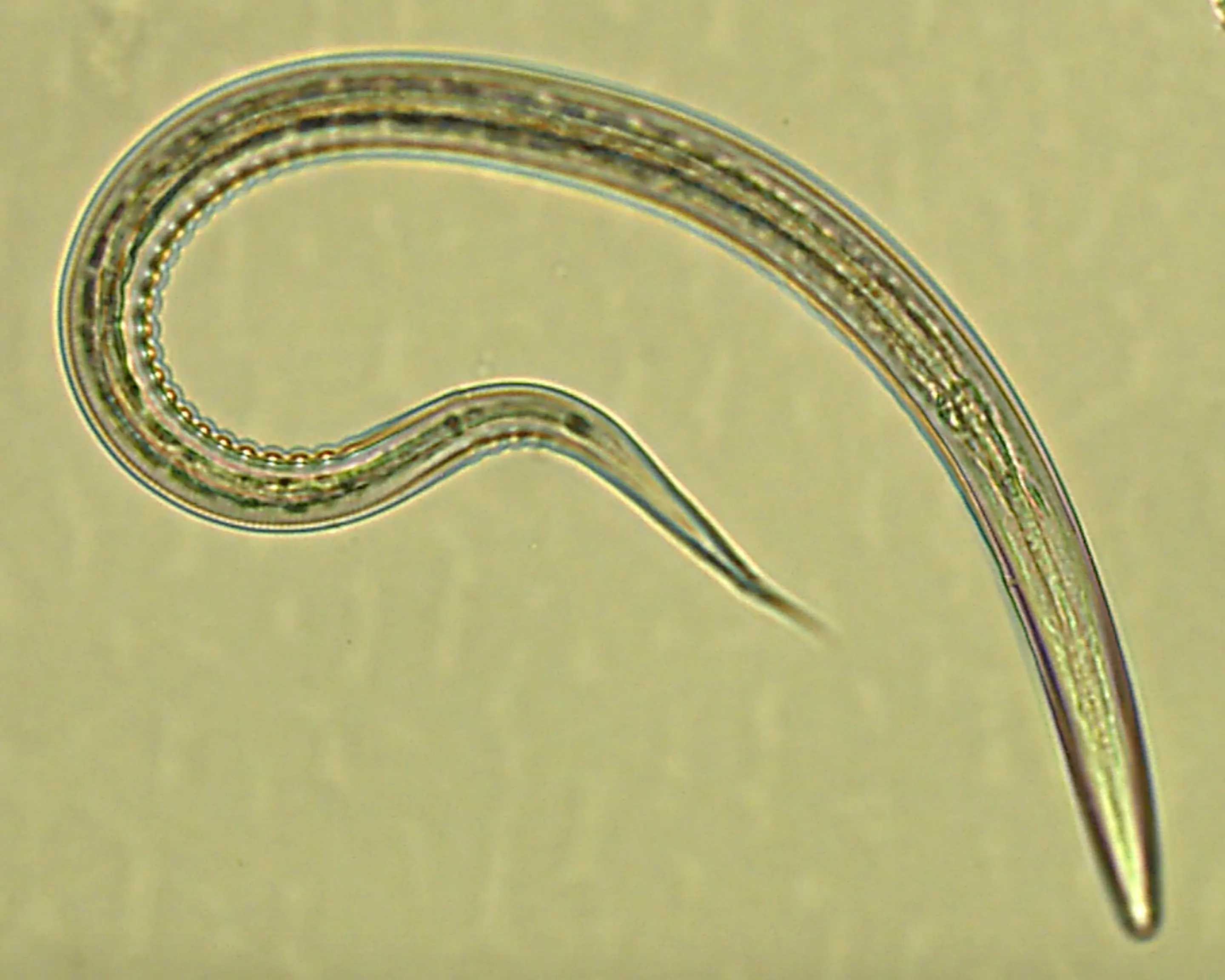 Людей заразили паразитическими червями, чтобы защитить их от диабета