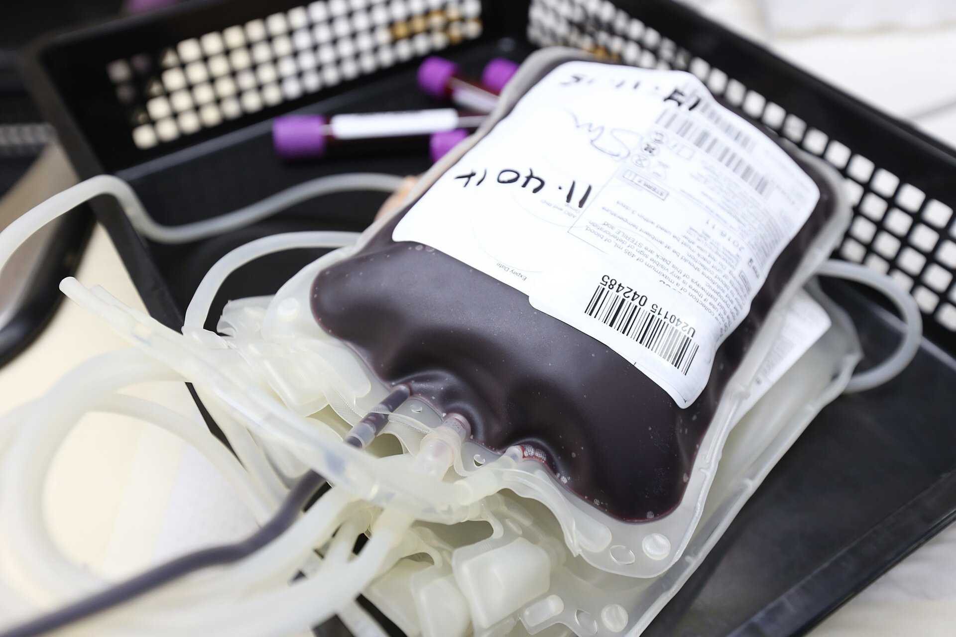 Риск внутричерепного кровоизлияния передался с донорской кровью