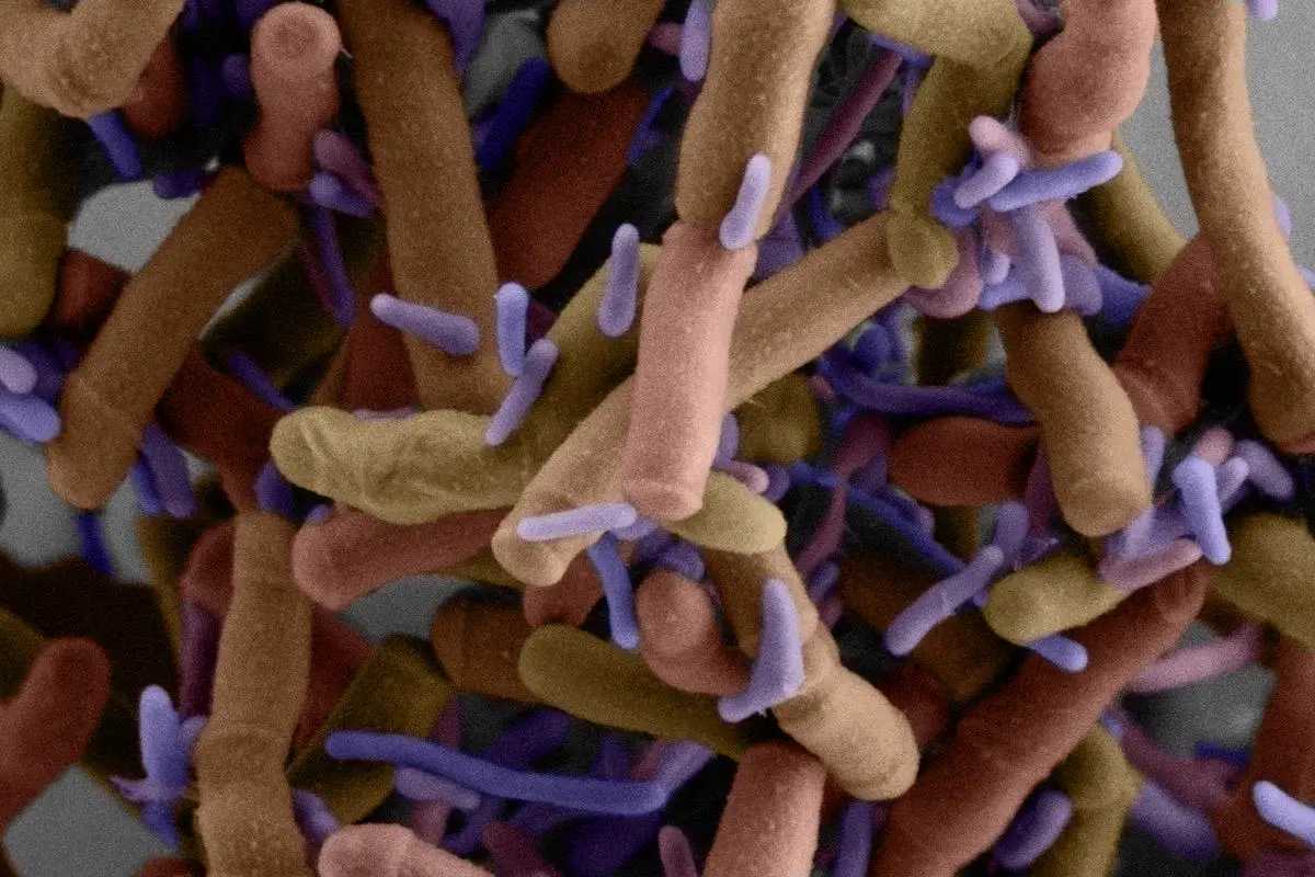 Микробиологи изучили бактерии Patescibacteria, которые обитают на поверхности других бактерий