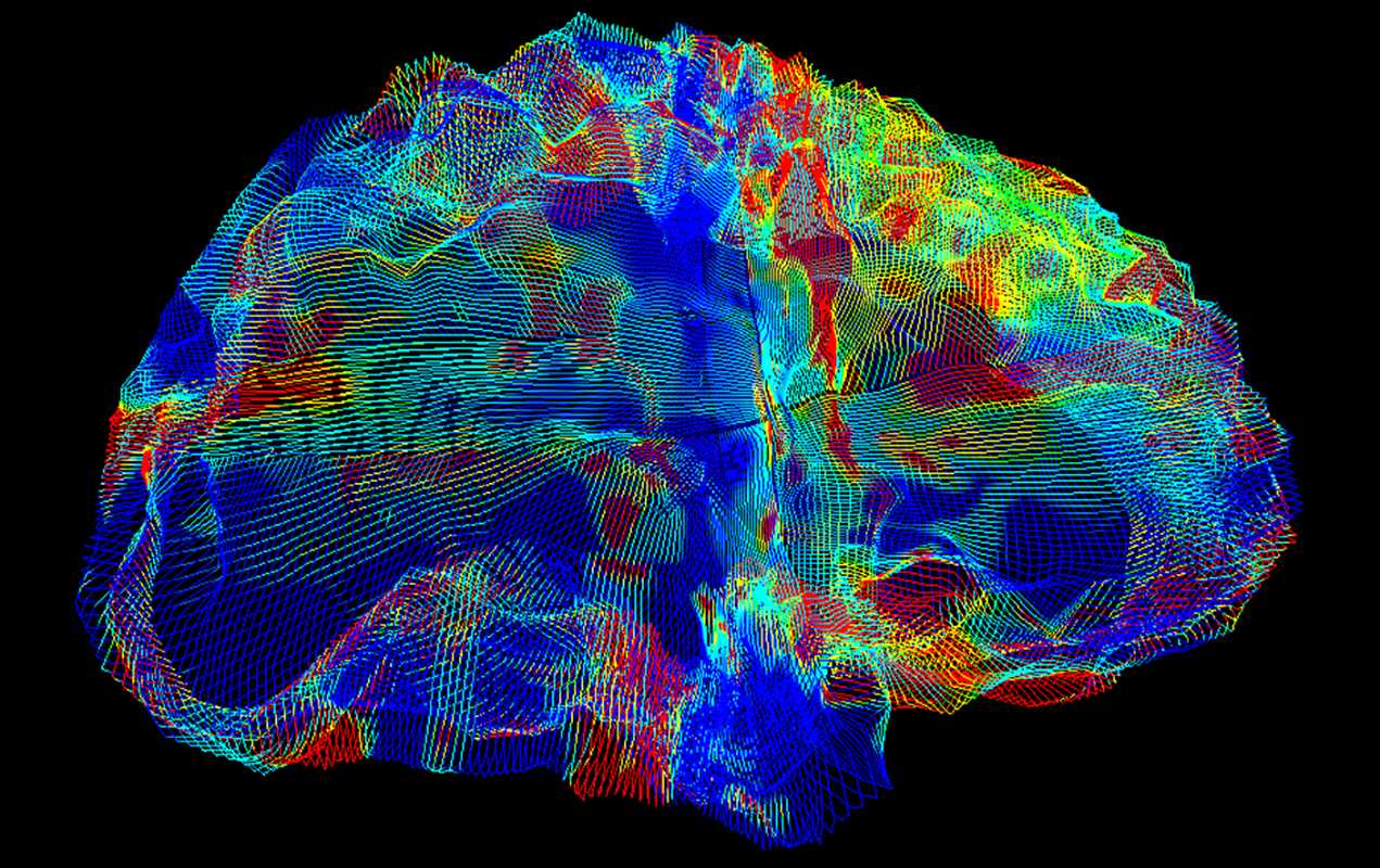 Гены и нейровизуализация: ИИ в погоне за болезнью Альцгеймера