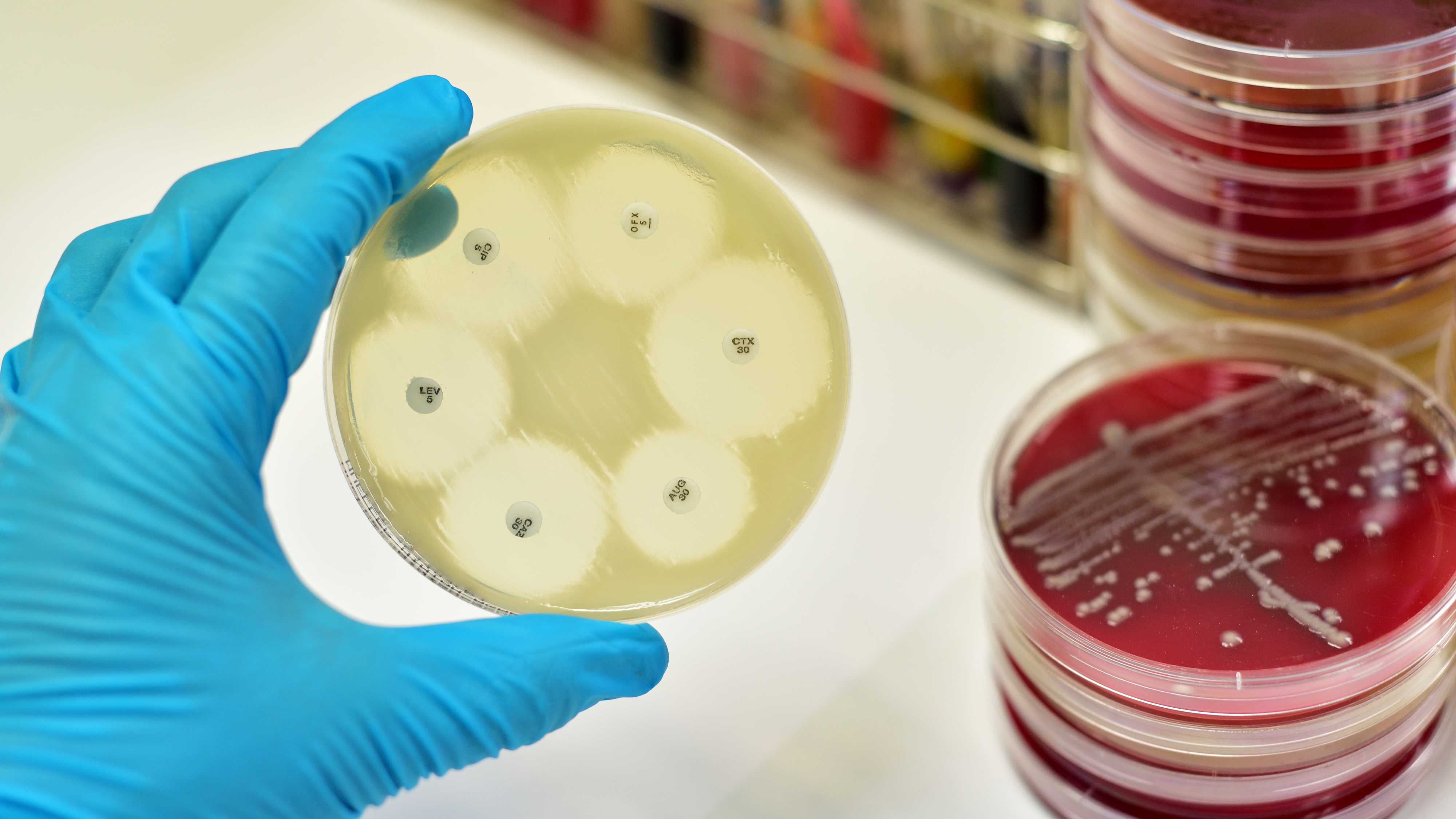 Устойчивость патогенов к антибиотикам связали с нехваткой витаминов