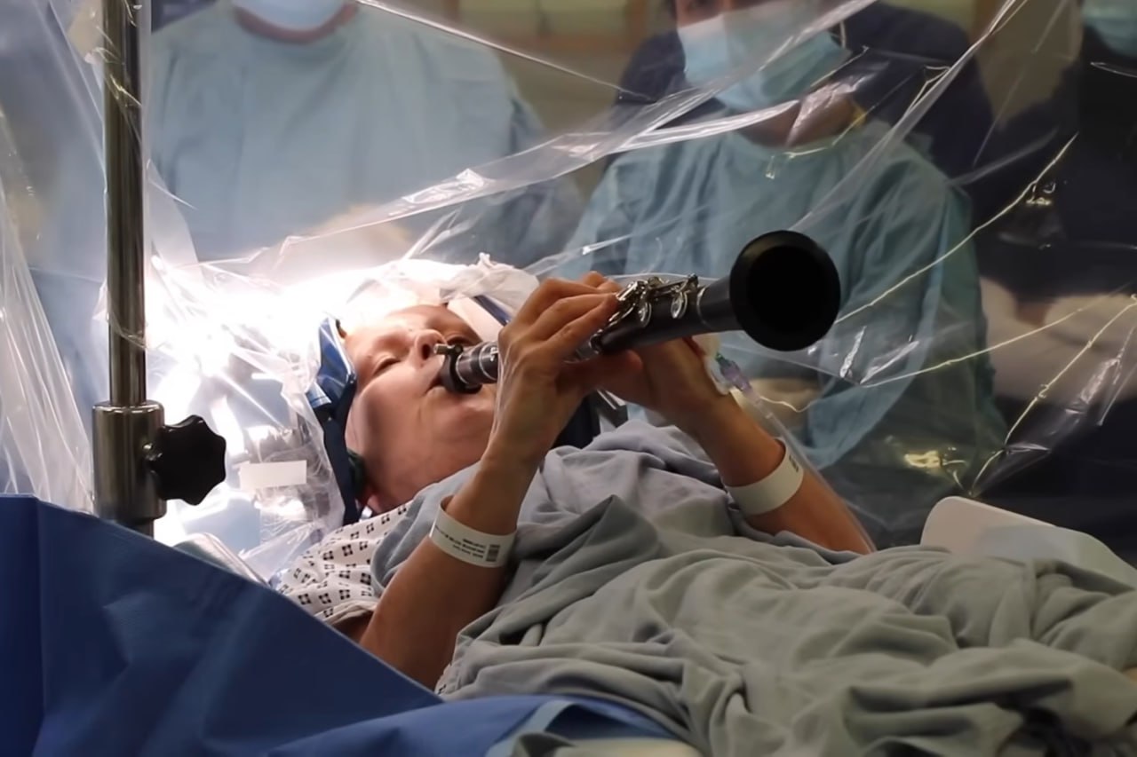 Игра на кларнете во время операции на мозге Игра на кларнете во время операции на мозге