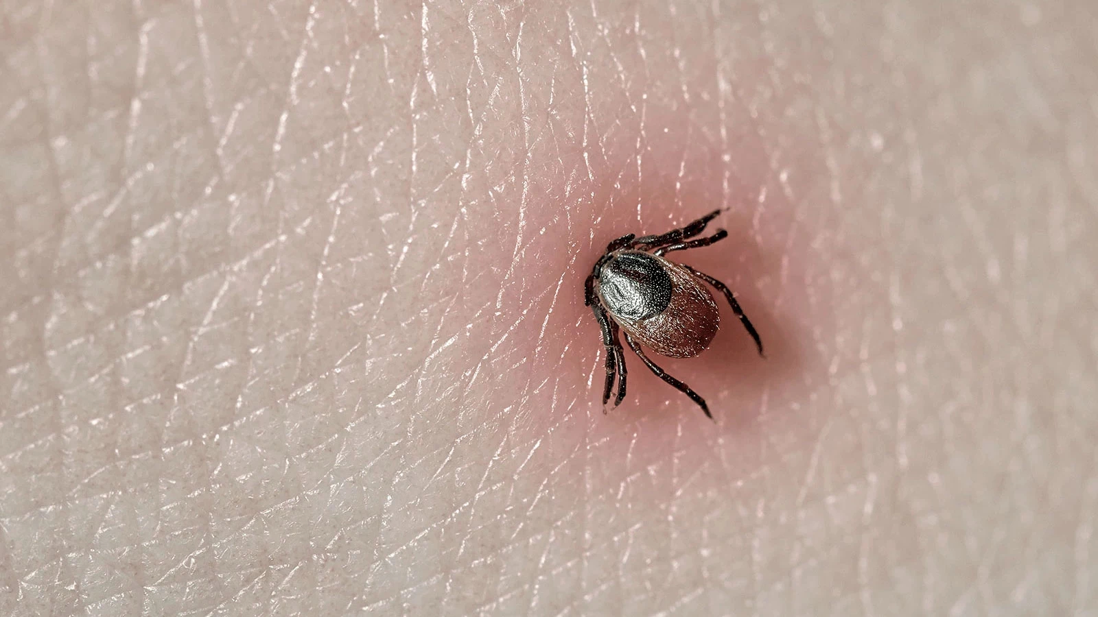 Зарегистрирована первая смерть от аллергии на мясо после укуса клеща Зарегистрирована первая смерть от аллергии на мясо после укуса клеща