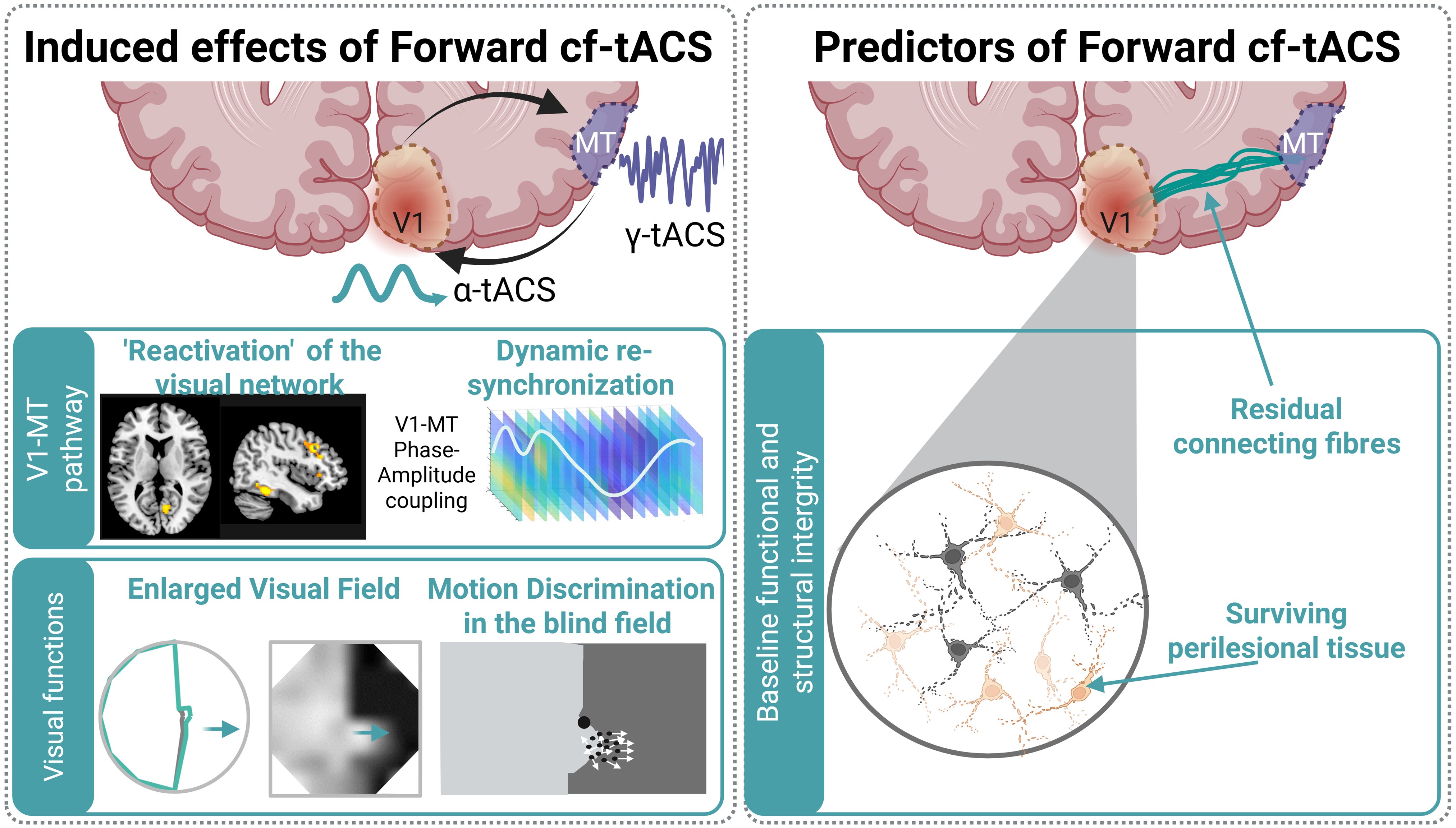Электрическая стимуляция мозга ускоряет восстановление зрения после инсульта Электрическая стимуляция мозга ускоряет восстановление зрения после инсульта