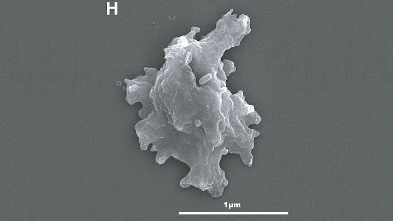 Амёба Incendiamoeba cascadensis Горячие амёбы