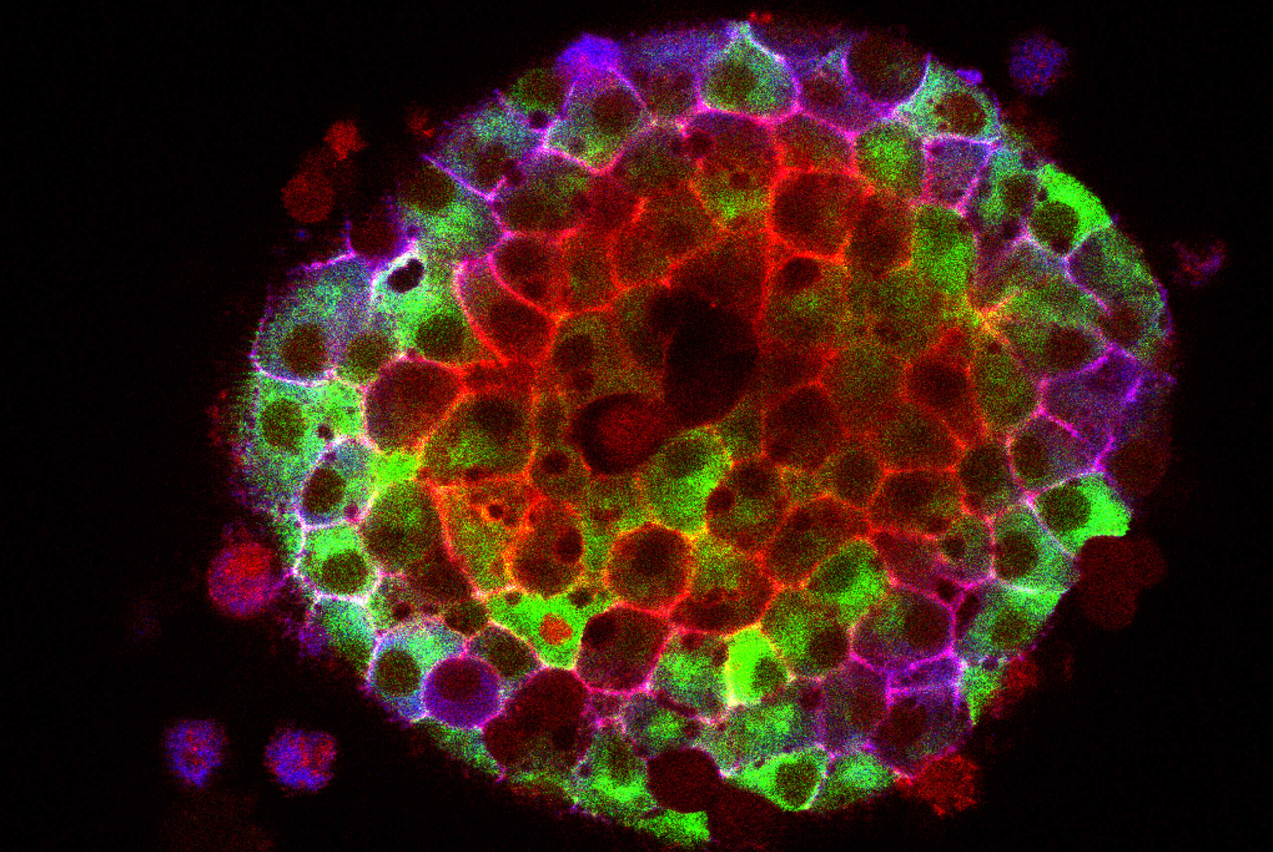Как микрофлора помогает бороться с диабетом Как микрофлора помогает бороться с диабетом