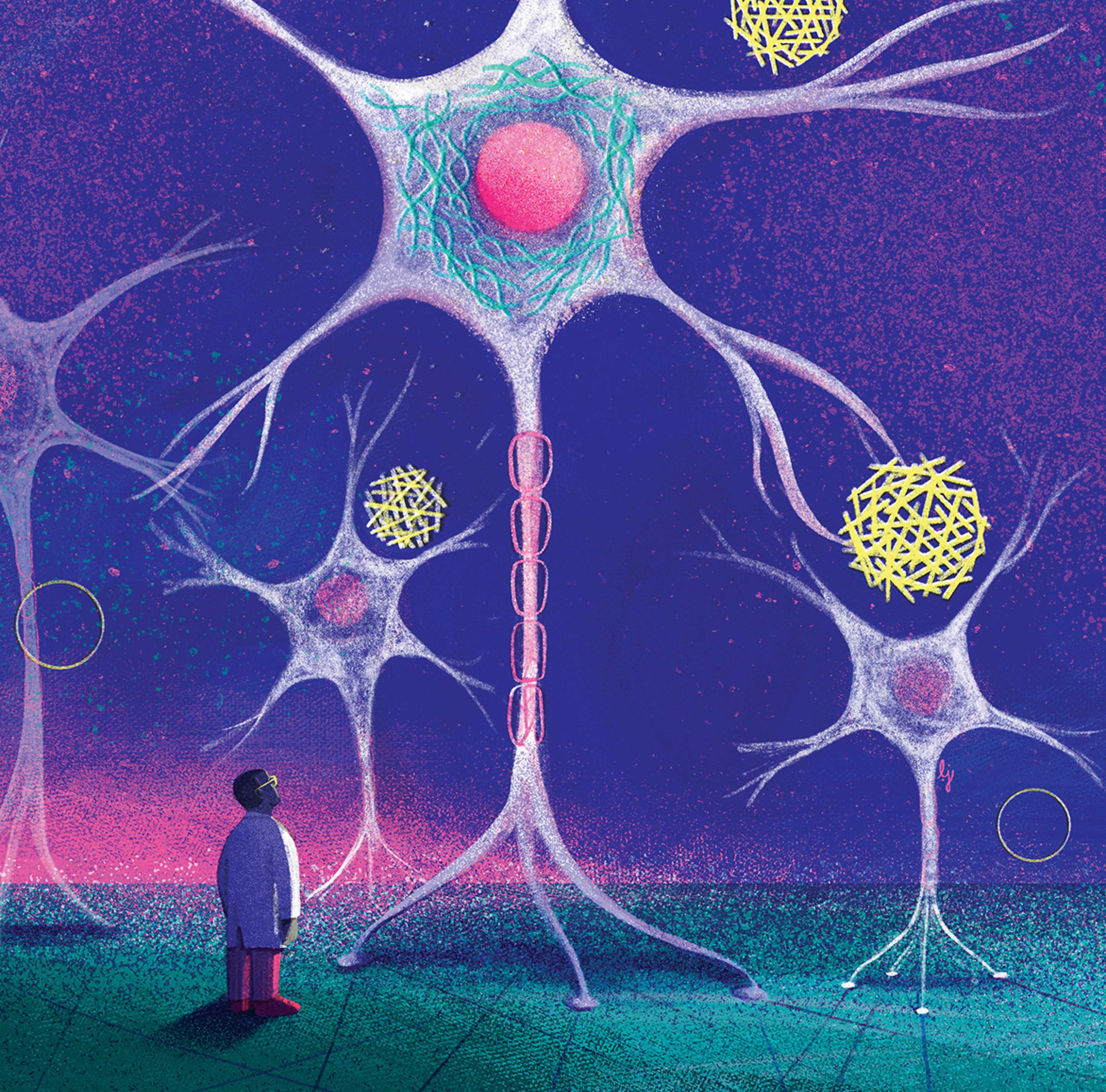 Новые горизонты в терапии болезни Альцгеймера Новые горизонты в терапии болезни Альцгеймера