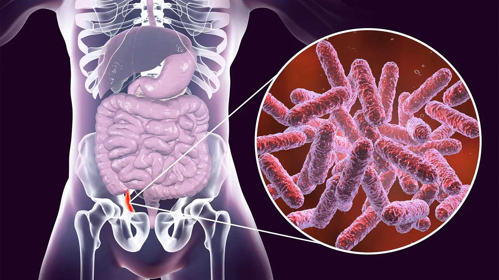 Десятилетнее наблюдение вновь показало эффективность лечения аппендицита антибиотиками Десятилетнее наблюдение вновь показало эффективность лечения аппендицита антибиотиками