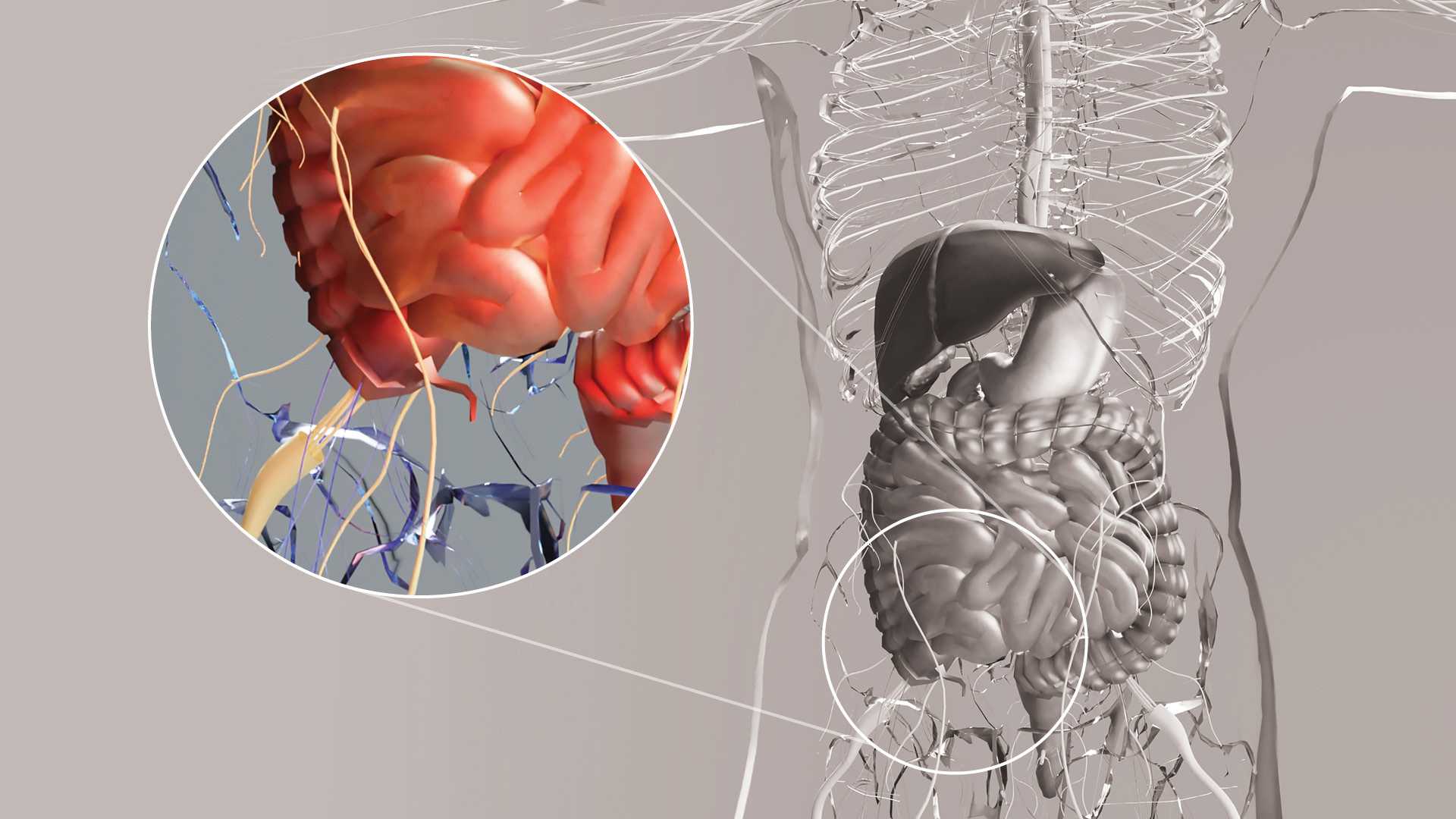 Антибиотики уступили операции при неосложненном аппендиците у детей Антибиотики уступили операции при неосложненном аппендиците у детей