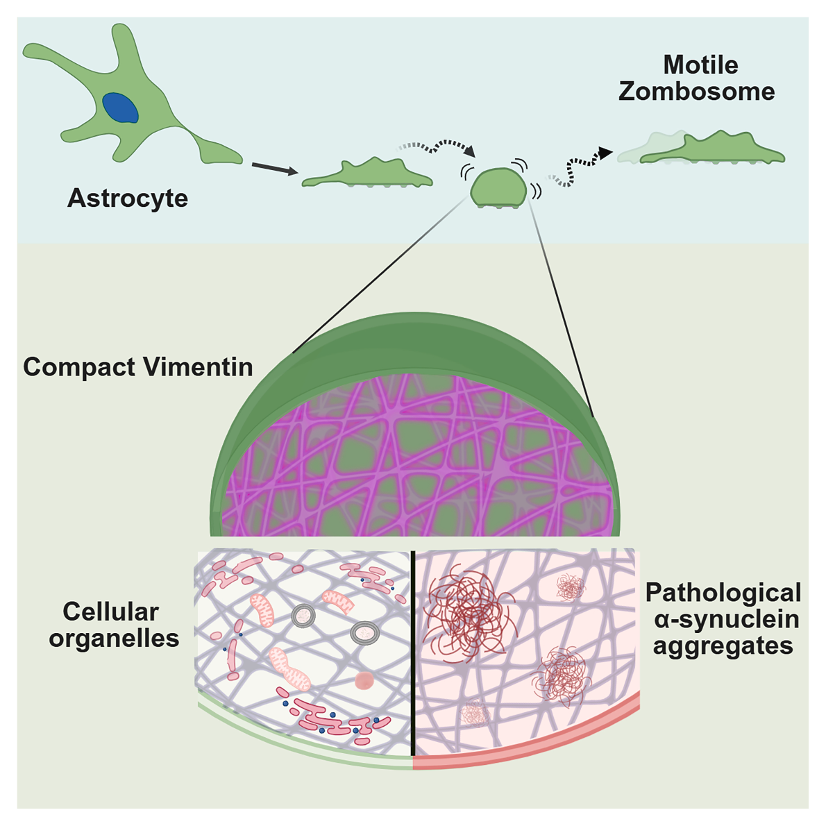 От астроцита «отпочковывается» подвижный «кусок», с патологическими альфа-синуклеиновыми агрегатами Астроциты распространяют болезнь Паркинсона с помощью «зомбосом»