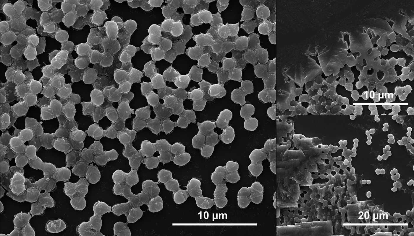 Колония бактерий Deinococcus radiodurans Ученые проверили, способны ли бактерии пережить удар астероида