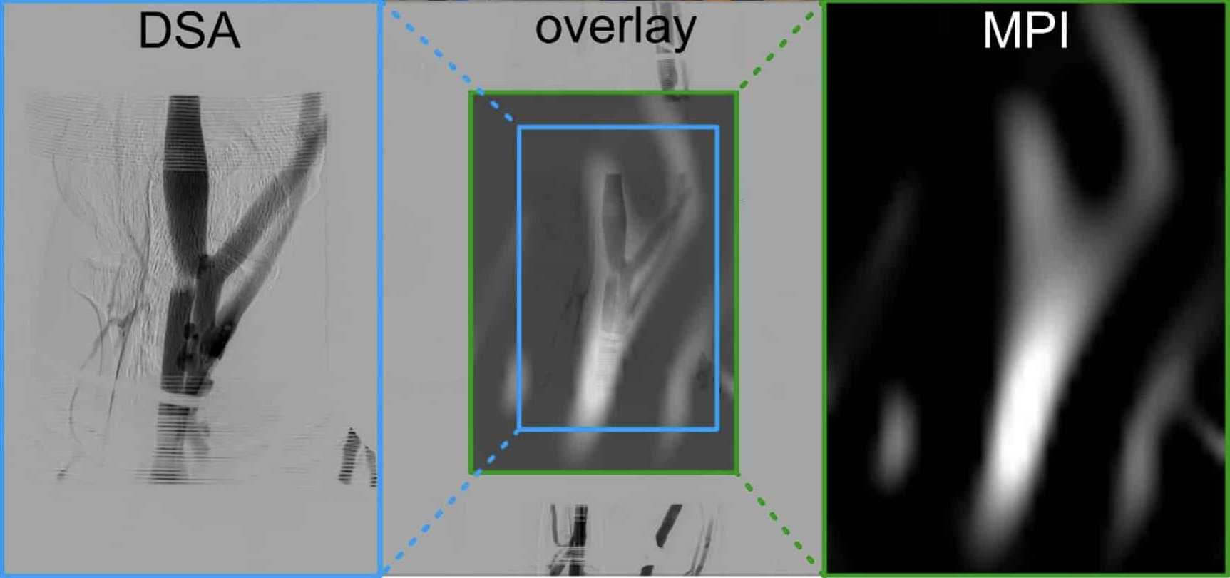 Магнитно-частичная томография впервые опробована на человеке Магнитно-частичная томография впервые опробована на человеке