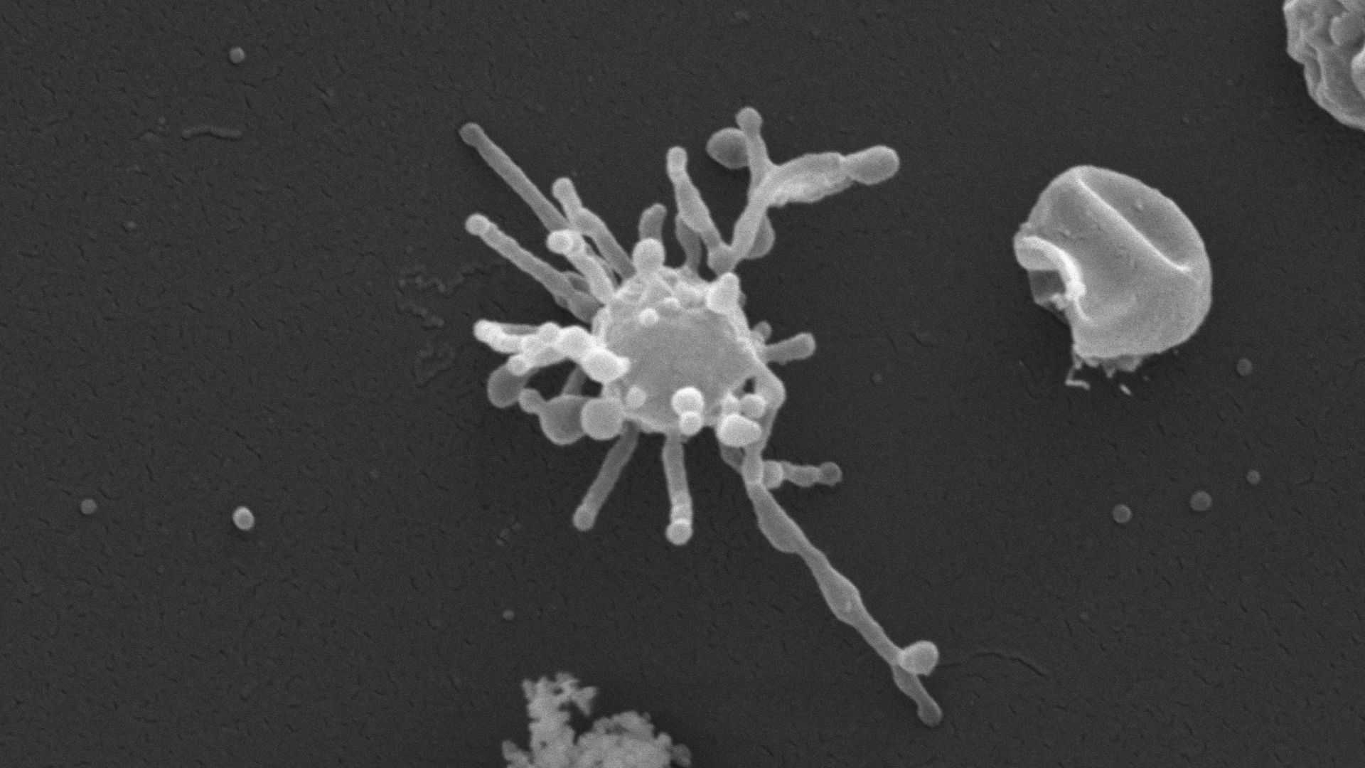 Асгард-археи и бактерии впервые показали прямой контакт, создавший предка всех животных и растений Асгард-археи и бактерии впервые показали прямой контакт, создавший предка всех животных и растений