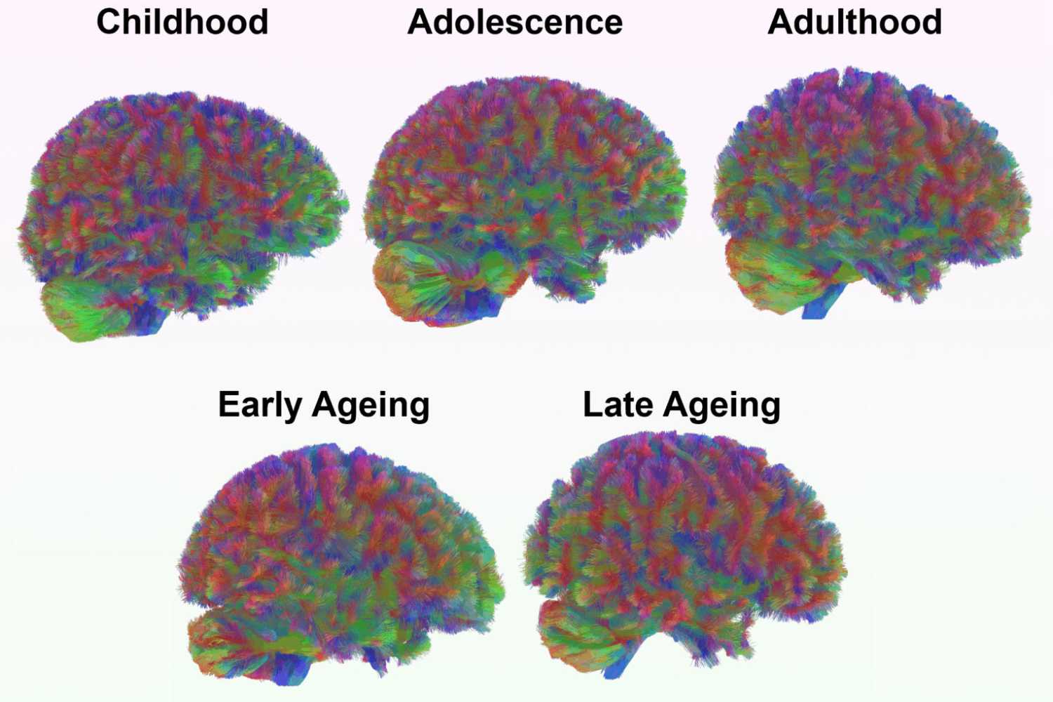 Мозг достигает пика своей активности к 32 годам Мозг достигает пика своей активности к 32 годам